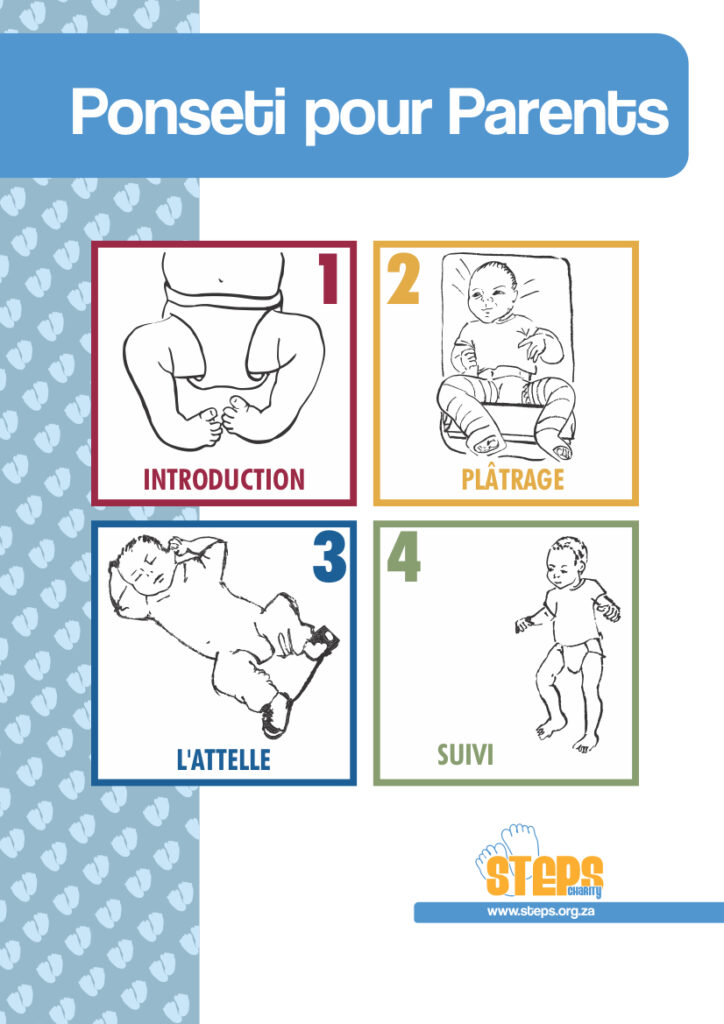 Ponseti for parents french web