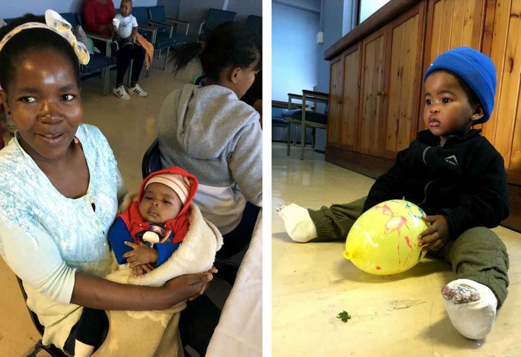 ponseti-party-3_compressed